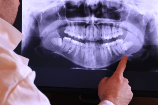 Best Same-Day Emergency Dentist in Five Points, NC